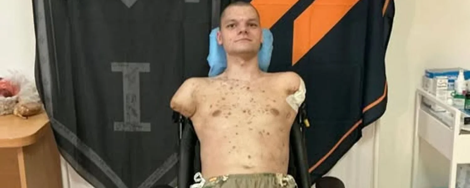 У відділенні ПриватБанку ветерану з ампутацією відмовили у відновленні картки: в НБУ відреагували